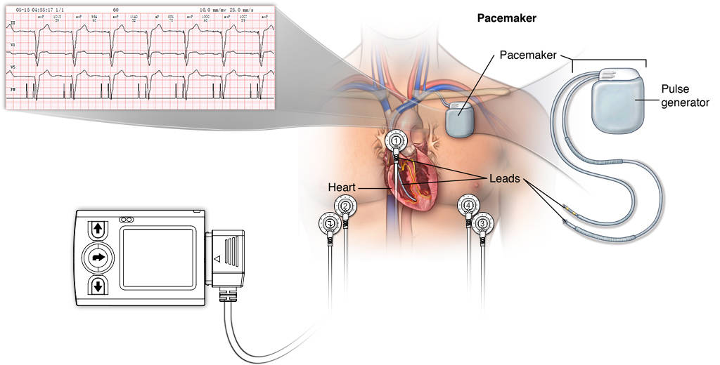iTengo+动态心电图记录器,动态心电记录器,动态心电记录仪,动态心电图,动态心电图记录仪,12导动态心电图机,24小时动态心电图检测,动态心电检测仪,心电监护仪,动态心电图工作站,远程心电网络,博声医疗,博声医械