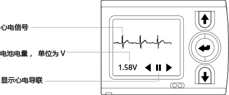 iTengo+动态心电图记录器,动态心电记录器,动态心电记录仪,动态心电图,动态心电图记录仪,12导动态心电图机,24小时动态心电图检测,动态心电检测仪,心电监护仪,动态心电图工作站,远程心电网络,博声医疗,博声医械