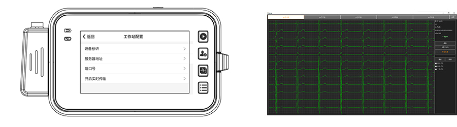 博声医疗,博声医械,ECG,心电图仪,心电图机,医院心电图机,12导心电图机,常规心电图,静态心电图,动态心电图,心电检测,心电图机工作站