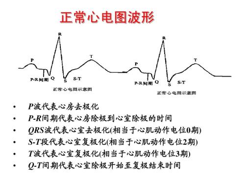 异常心电图心电图异常