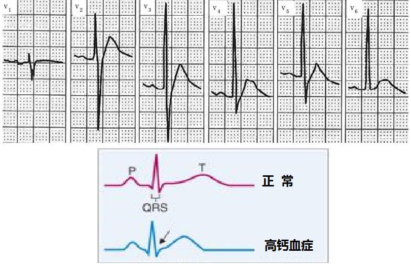 st段改变,st段改变是什么意思?